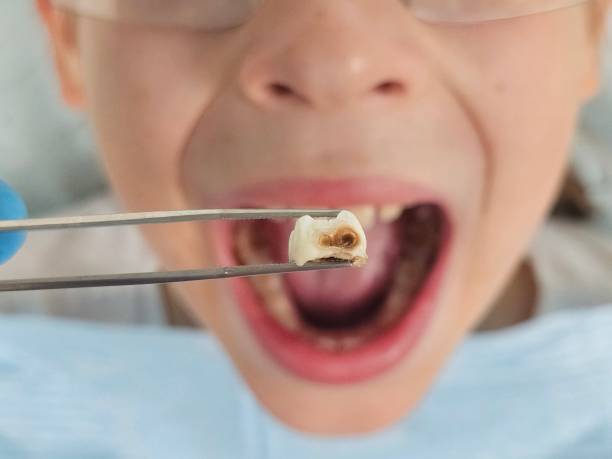 Best Tooth Pain Emergency Relief  in Old Stine, CA